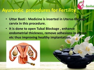 Thumbnail for Infertility Treatment By Ayurveda Alternate Treatment To Ivf In Delhi