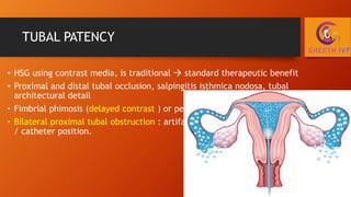 Patss Infertility Workup.pptx