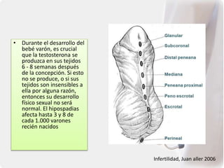 • Durante el desarrollo del
bebé varón, es crucial
que la testosterona se
produzca en sus tejidos
6 - 8 semanas después
de la concepción. Si esto
no se produce, o si sus
tejidos son insensibles a
ella por alguna razón,
entonces su desarrollo
físico sexual no será
normal. El hipospadias
afecta hasta 3 y 8 de
cada 1.000 varones
recién nacidos
Infertilidad, Juan aller 2006
 
