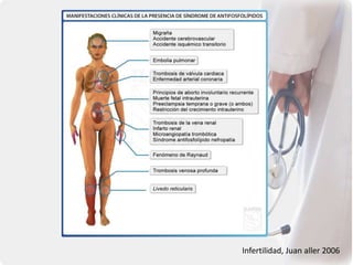 Infertilidad, Juan aller 2006
 