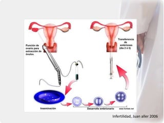 Infertilidad, Juan aller 2006
 