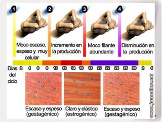 Infertilidad, Juan aller 2006
 
