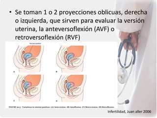 • Se toman 1 o 2 proyecciones oblicuas, derecha
o izquierda, que sirven para evaluar la versión
uterina, la anteversoflexión (AVF) o
retroversoflexión (RVF)
Infertilidad, Juan aller 2006
 