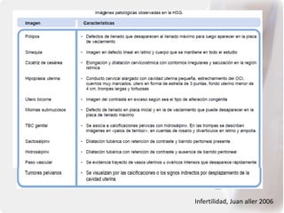 Infertilidad, Juan aller 2006
 