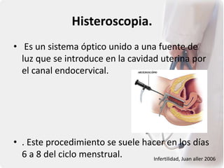 Histeroscopia.
• Es un sistema óptico unido a una fuente de
luz que se introduce en la cavidad uterina por
el canal endocervical.
• . Este procedimiento se suele hacer en los días
6 a 8 del ciclo menstrual. Infertilidad, Juan aller 2006
 