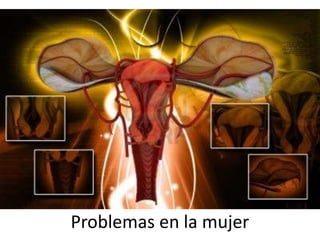 Problemas en la mujer
 