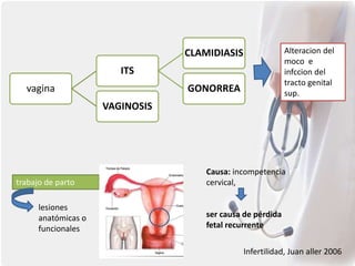 vagina
ITS
CLAMIDIASIS
GONORREA
VAGINOSIS
Infertilidad, Juan aller 2006
Alteracion del
moco e
infccion del
tracto genital
sup.
trabajo de parto
lesiones
anatómicas o
funcionales
Causa: incompetencia
cervical,
ser causa de pérdida
fetal recurrente
 