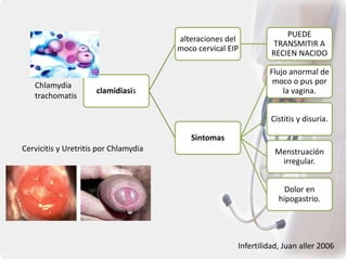 clamidiasis
alteraciones del
moco cervical EIP
PUEDE
TRANSMITIR A
RECIEN NACIDO
Sintomas
Flujo anormal de
moco o pus por
la vagina.
Cistitis y disuria.
Menstruación
irregular.
Dolor en
hipogastrio.
Infertilidad, Juan aller 2006
Chlamydia
trachomatis
Cervicitis y Uretritis por Chlamydia
 