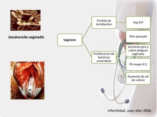 Vaginosis
Perdida de
lactobacilos
Hay EIP
Proliferacion de
bacterias
anaerobias
Olor pescado
Secrecion gris y
cubre pliegues
vaginales
Ph mayor 4.5
Aumento de cel
de indicio
Infertilidad, Juan aller 2006
Gardnerella vaginallis
 