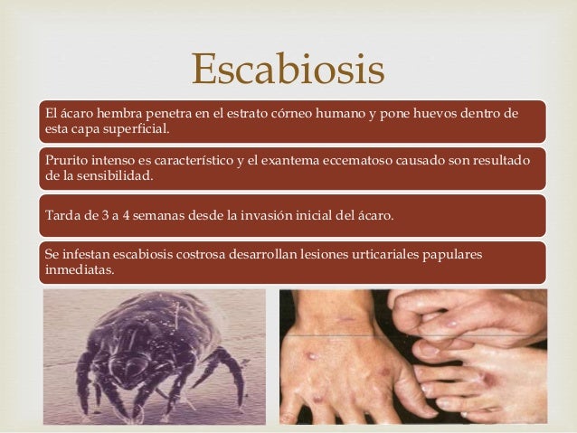La crema belosalik de la psoriasis las revocaciones