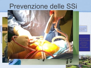 Prevenzione delle SSi
 