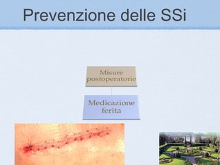 Prevenzione delle SSi
 
