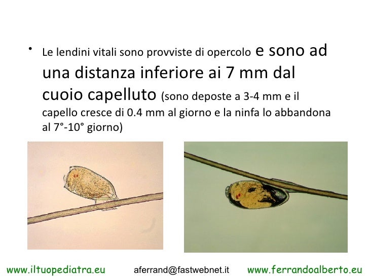 Infezioni E Infestazioni E Pidocchi Da Ferrando