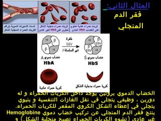 ‫ا‬‫الثاني‬ ‫لمثال‬:
‫الدم‬ ‫فقر‬
‫المنجلي‬
‫له‬ ‫و‬ ‫الحمراء‬ ‫الكريات‬ ‫داخل‬ ‫يوجد‬ ‫بروتين‬ ‫الدموي‬ ‫الخضاب‬
‫بنيوي‬ ‫و‬ ‫التنفسية‬ ‫الغازات‬ ‫نقل‬ ‫في‬ ‫يتجلى‬ ‫وظيفي‬ ، ‫دورين‬
.  ‫الحمراء‬ ‫للكريات‬ ‫المقعر‬ ‫الكروي‬ ‫الشكل‬ ‫إعطاء‬ ‫في‬ ‫يتجلى‬
‫دموي‬ ‫خضاب‬ ‫تركيب‬ ‫عن‬ ‫المنجلي‬ ‫الدم‬ ‫فقر‬ ‫ينتج‬Hemoglobine
)‫الحمراء‬ ‫الكريات‬ ‫تشوه‬ ‫عادي‬ ‫غير‬‫الشكل‬ ‫منجلية‬ ‫تصبح‬(‫و‬
 