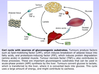 Cori cycle with sources of gluconeogenic substrates.  Tumours produce factors such as lipid-mobilizing factor (LMF), which induces breakdown of adipose tissue into fatty acids, and proteolysis-inducing factor (PIF), which induces protein degradation (amino acids) in skeletal muscle. Tumour necrosis factor (TNF)-   also contributes to these processes. These are important gluconeogenic substrates that can be used in acute-phase protein (APP) synthesis by the liver. Tumours convert glucose to lactate, which is transferred to the liver, where it is converted back into glucose. This cycle uses a large amount of energy, and might contribute to cachexia. 