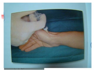 Rizartrosis Aguja naranja Jeringa 2cc - 5cc 0,5 cc cort. depot 0,5 cc anestésico 