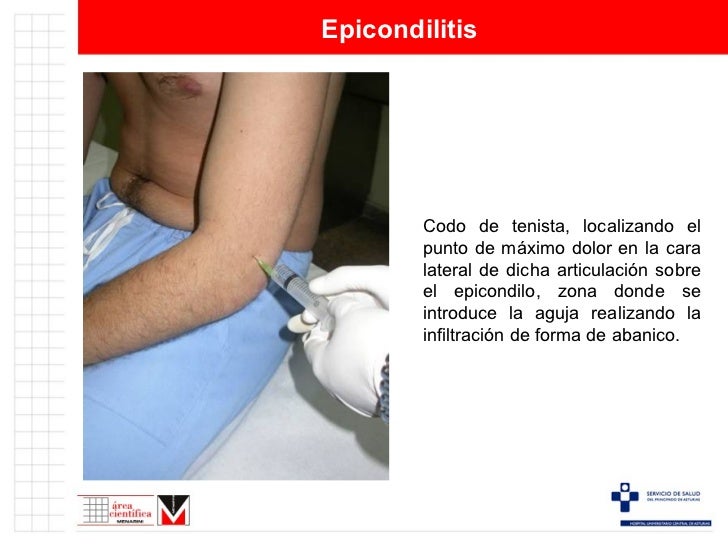 Como Se Hacen Las Infiltraciones En La Columna Infiltraciones