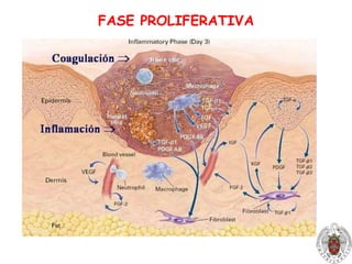 Daño: células endoteliales; eritrocitos y céls. de parénquima; inactiv. antiproteasas