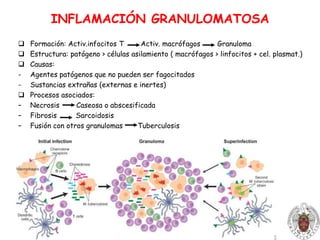 Otras                              α2-macroglobulinaÓxido nítrico (NO)Vasodilatador
