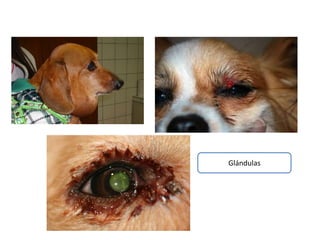 Glándulas
 