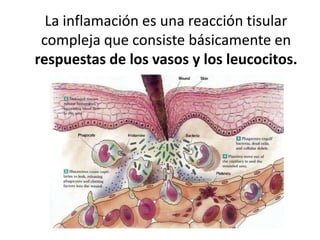 La inflamación es una reacción tisular
compleja que consiste básicamente en
respuestas de los vasos y los leucocitos.
 