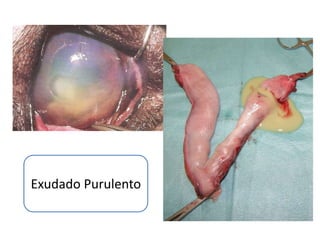 Exudado Purulento
 