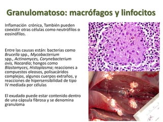 Granulomatoso: macrófagos y linfocitos
Inflamación crónica, También pueden
coexistir otras células como neutrófilos o
eosinófilos.
Entre las causas están: bacterias como
Brucella spp., Mycobacterium
spp., Actinomyces, Corynebacterium
ovis, Nocardia; hongos como
Blastomyces, Histoplasma; reacciones a
compuestos oleosos, polisacáridos
complejos, algunos cuerpos extraños, y
reacciones de hipersensibilidad de tipo
IV mediada por células
El exudado puede estar contenido dentro
de una cápsula fibrosa y se denomina
granuloma
 