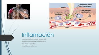 Inflamación 
Facultad de Odontología UAdeC U.S 
Bioquímica General & Odontológica 
Dra. Alicia López Ríos 
Angel Cordova Ramos 
 