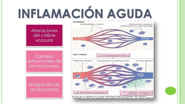 Inflamación