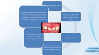 Una inflamación aguda puede
transformarse en crónica
Absceso crónico: la cavidad del
absceso que contiene pus, se
recubre con tejido conectivo
inmaduro
Inflamación crónica
el área central de necrosis por
licuefacción (pus) está envuelto por
una pared de tejido inflamatorio
crónico.
La pared alrededor de un absceso
se denomina membrana
piogénica. Piogénica significa que
produce pus.
Las fibras de colágena están orientadas alrededor
de la periferia de la lesión, formando una especie
de cápsula. Además de los fibroblastos y células
endoteliales, un número variable de linfocitos y
macrófagos se encuentran dentro de la membrana
piogénica.
 