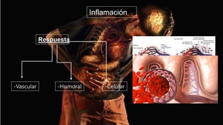 Inflamación
-Celular
Respuesta
-Vascular -Humoral
 