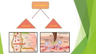 LA INFLAMACION
VASCULAR CELULAR
 