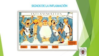SIGNOS DE LA INFLAMACIÓN
 