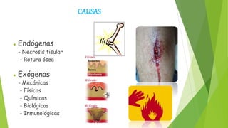 CAUSAS
 Endógenas
- Necrosis tisular
- Rotura ósea
 Exógenas
- Mecánicas
- Físicas
- Químicas
- Biológicas
- Inmunológicas
 