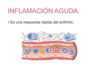 INFLAMACIÓN AGUDA.
• Es una respuesta rápida del anfitrión.
 