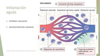 Inflamación
aguda
 Cambios vasculares
 Acontecimientos
celulares
Tomado de: Robbins, Bases Patológicas de la Enfermedad. 8a edición.
 