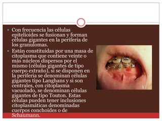  Con frecuencia las células 
epitelioides se fusionan y forman 
células gigantes en la periferia de 
los granulomas. 
 Están constituidas por una masa de 
citoplasma que contiene veinte o 
más núcleos dispersos por el 
mismo (células gigantes de tipo 
cuerpo extraño), si se disponen en 
la periferia se denominan células 
gigantes tipo Langhans y si son 
centrales, con citoplasma 
vacuolado, se denominan células 
gigantes de tipo Touton. Estas 
células pueden tener inclusiones 
citoplasmáticas denominadas 
cuerpos conchoides o de 
Schaumann. 
 
