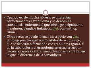 Cuando existe mucha fibrosis se diferencia 
perfectamente el granuloma y se denomina 
sarcoidosis: enfermedad que afecta principalmente 
al pulmón, ganglios linfáticos, piel, conjuntiva, 
riñón... 
 Otras veces se puede formar un espacio con gas, 
también pueden aparecer cristales de ácido úrico, 
que se depositan formando ese granuloma (gota). Y 
en la tuberculosis el granuloma se caracteriza por 
necrosis caseosa central sin inclusiones y sin fibrosis, 
lo que lo diferencia de la sarcoidosis. 
 
