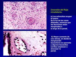 Inversión del flujo circulatorio.  a) Los eritrocitos ocupan el centro de la luz de los vasos dilatados, mientras que los leucocitos están marginados a lo largo de la pared. b) Mayor aumento de una vénula, en donde la marginación leucocitaria es aparente y algunos leucocitos (arriba) empiezan a atravesar la pared. 