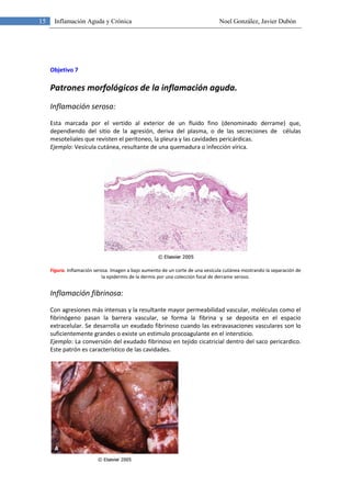 15 Inflamación Aguda y Crónica Noel González, Javier Dubón
Objetivo 7
Patrones morfológicos de la inflamación aguda.
Infla...
