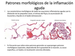Patrones morfológicos de la inflamación 
aguda 
• Las características morfológicas de todas las reacciones inflamatorias agudas son la 
dilatación de los pequeños vasos, el retraso del flujo y la acumulación de 
leucocitos y líquido en el tejido extravascular . 
• Es frecuente que sobre estos patrones generales se superpongan patrones 
morfológicos especiales, dependiendo de la gravedad de la reacción, su causa 
específica, y el tejido y la localización concreta afectadas. 
 