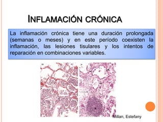 La inflamación crónica tiene una duración prolongada 
(semanas o meses) y en este período coexisten la 
inflamación, las lesiones tisulares y los intentos de 
reparación en combinaciones variables. 
Millan, Estefany 
 