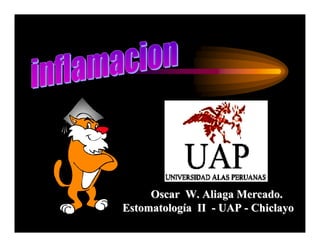 Oscar W. Aliaga Mercado.
Estomatología II - UAP - Chiclayo
 