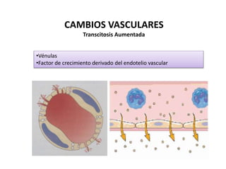 CAMBIOS VASCULARES
Transcitosis Aumentada
•Vénulas
•Factor de crecimiento derivado del endotelio vascular
 