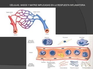 Alteraciones en las estructuras de la microvasculatura, que permiten la salida de la circulación a las proteínas plasmáticas y los leucocitos 