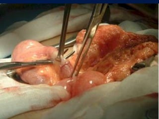 Las glucoproteínas del tipo mucina 