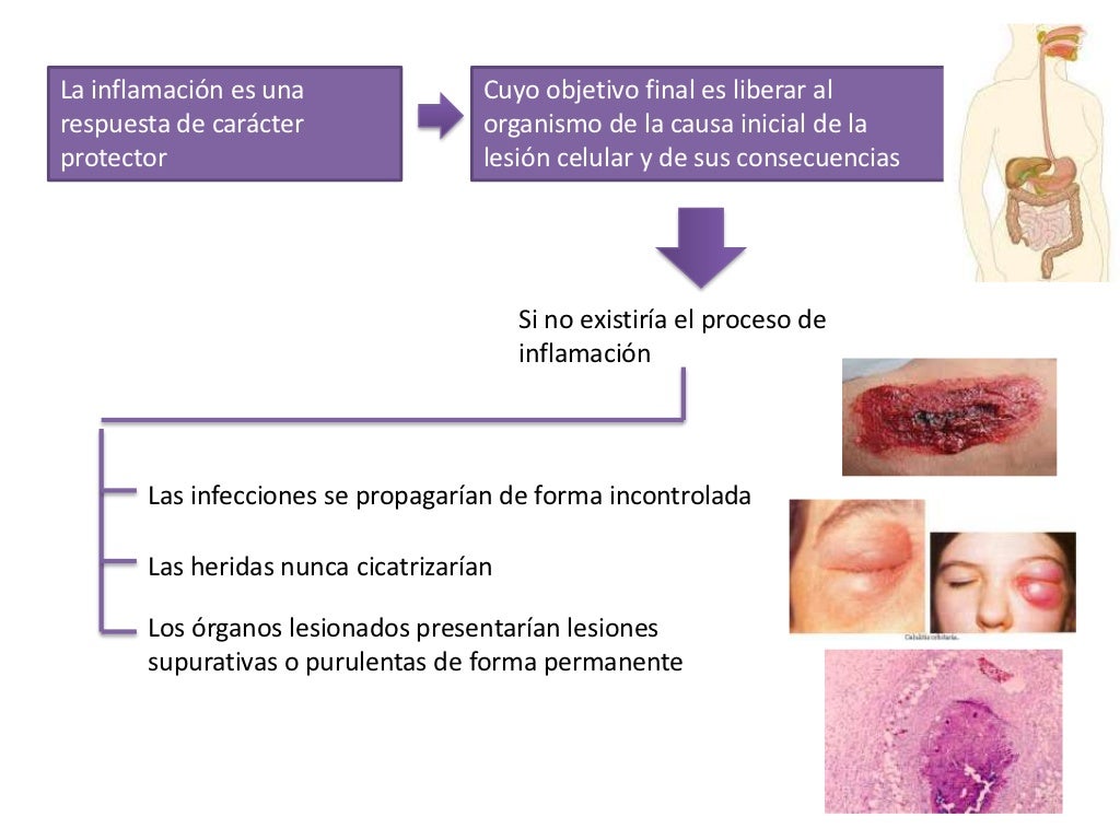 Inflamacion aguda y cronica.