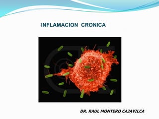 INFLAMACION  CRONICA DR. RAUL MONTERO CAJAVILCA 