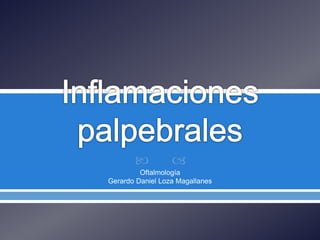  
Oftalmología
Gerardo Daniel Loza Magallanes
 