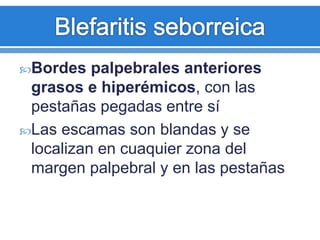 Bordes palpebrales anteriores
grasos e hiperémicos, con las
pestañas pegadas entre sí
Las escamas son blandas y se
localizan en cuaquier zona del
margen palpebral y en las pestañas
 
